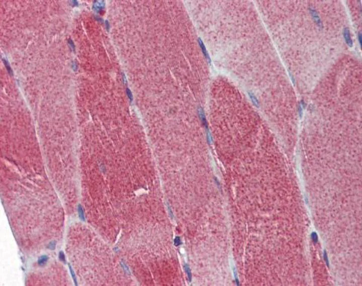 Immunohistochemistry (Formalin/PFA-fixed paraffin-embedded sections) - Anti-POLG antibody (AB97661)