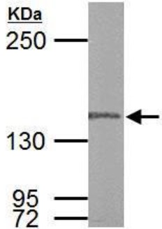 Western blot - Anti-POLG antibody (AB97661), expandable thumbnail