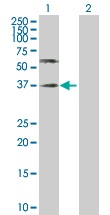 Western blot - Anti-Poliovirus Receptor/PVR antibody (AB103630), expandable thumbnail
