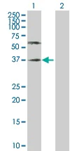 Western blot - Anti-Poliovirus Receptor/PVR antibody (AB103630)
