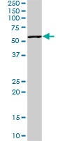 Western blot - Anti-Poliovirus Receptor/PVR antibody (AB103630), expandable thumbnail