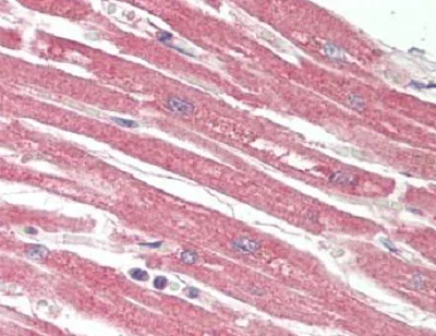 Immunohistochemistry (Formalin/PFA-fixed paraffin-embedded sections) - Anti-Poliovirus Receptor/PVR antibody (AB230338)