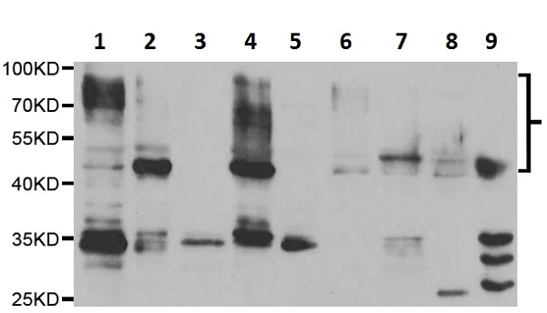 Western blot - Anti-Poliovirus Receptor/PVR antibody (AB230338)