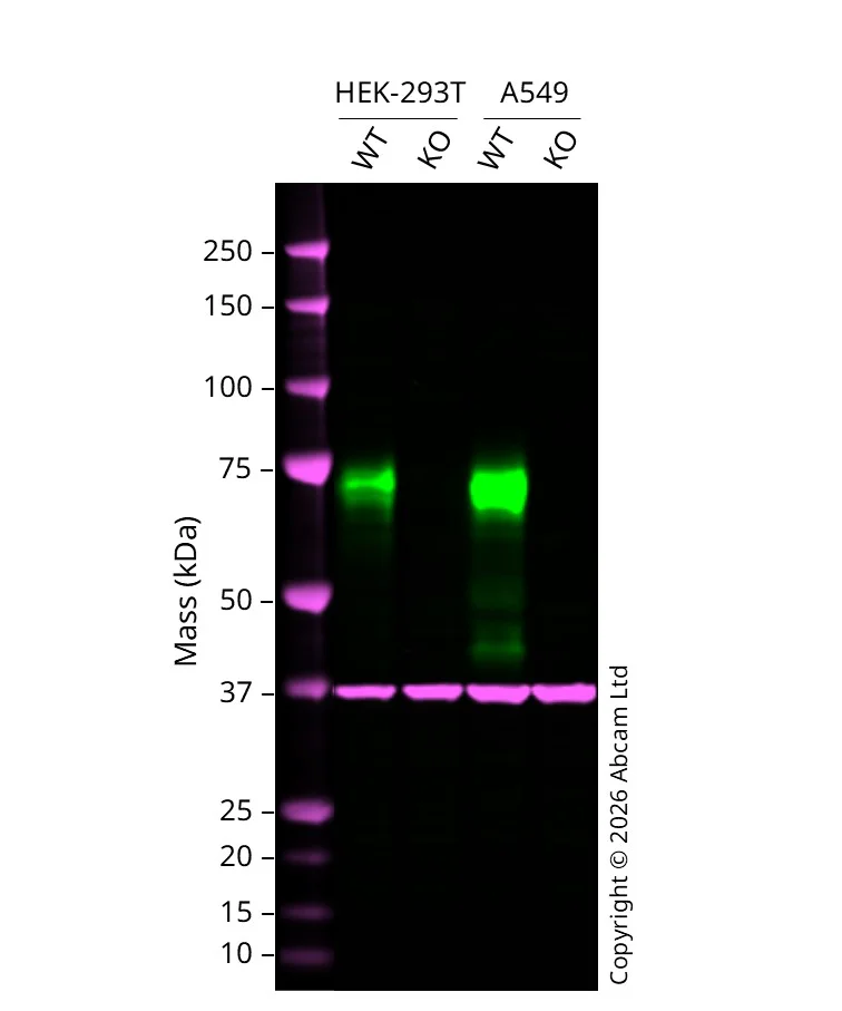 Western blot - Anti-Poliovirus Receptor/PVR antibody [EPR17302] (AB205304)