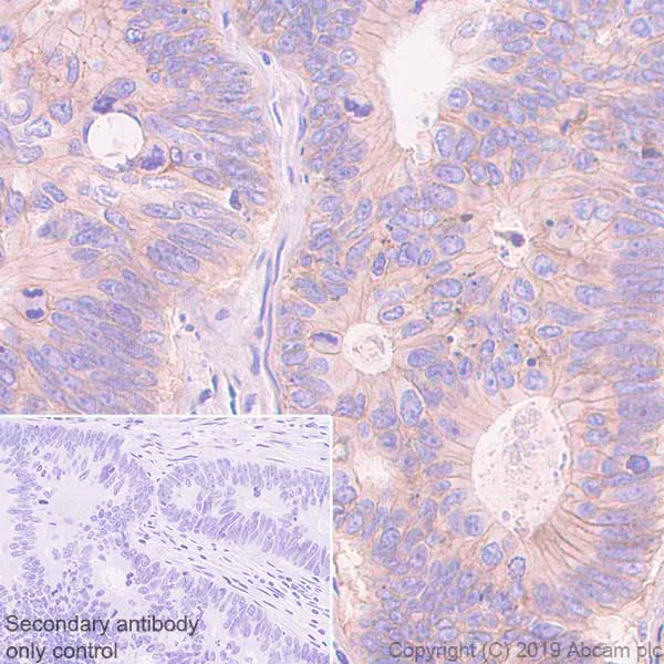 Immunohistochemistry (Formalin/PFA-fixed paraffin-embedded sections) - Anti-Poliovirus Receptor/PVR antibody [EPR22672-151] (AB267788)