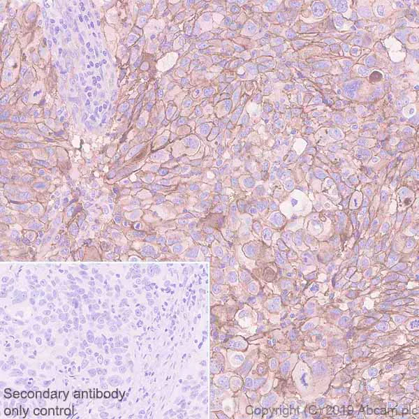 Immunohistochemistry (Formalin/PFA-fixed paraffin-embedded sections) - Anti-Poliovirus Receptor/PVR antibody [EPR22672-151] - BSA and Azide free (AB267794)