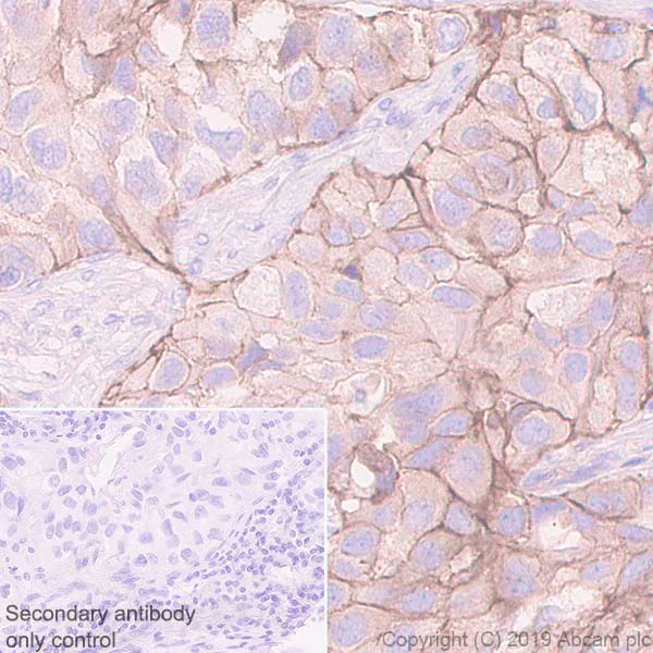 Immunohistochemistry (Formalin/PFA-fixed paraffin-embedded sections) - Anti-Poliovirus Receptor/PVR antibody [EPR22672-151] - BSA and Azide free (AB267794)