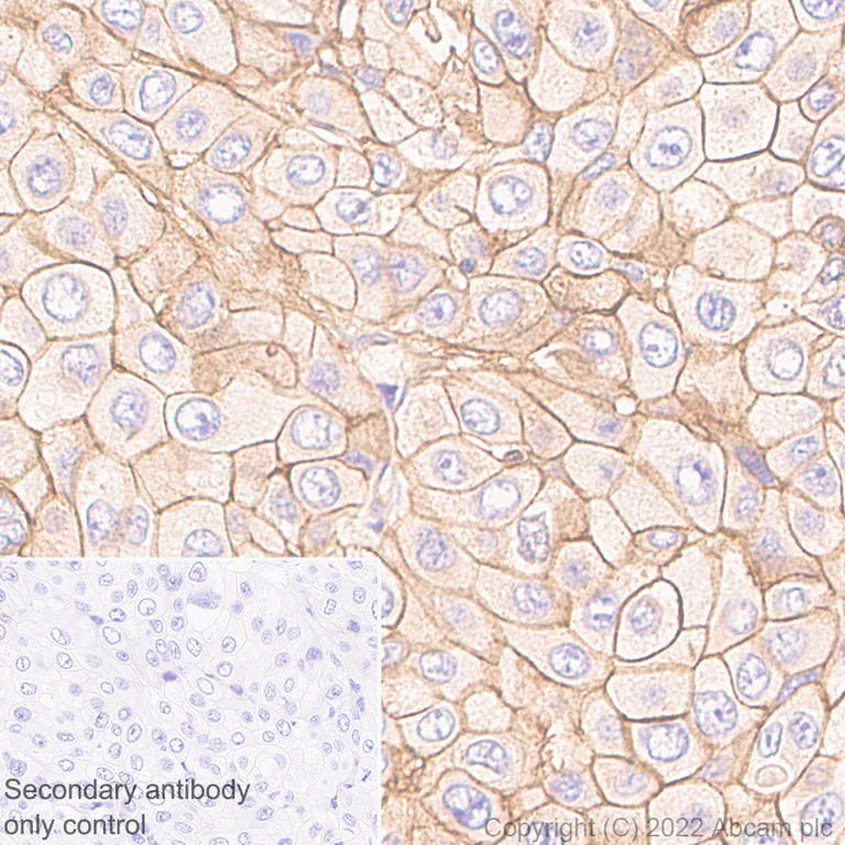 Immunohistochemistry - Anti-Poliovirus Receptor/PVR antibody [EPR22672-151] - Rat IgG1 (Chimeric) (AB307687)