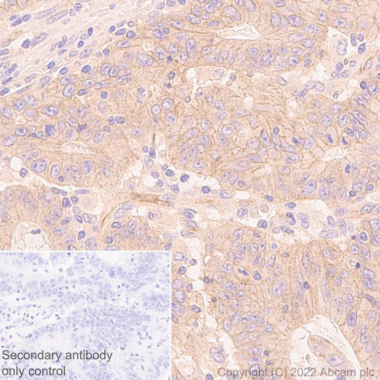 Immunohistochemistry - Anti-Poliovirus Receptor/PVR antibody [EPR22672-151] - Rat IgG1 (Chimeric) - BSA and Azide free (AB307688)
