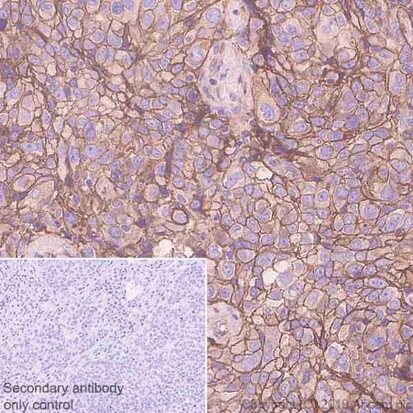 Immunohistochemistry (Formalin/PFA-fixed paraffin-embedded sections) - Anti-Poliovirus Receptor/PVR antibody [EPR23074-270] (AB267389)