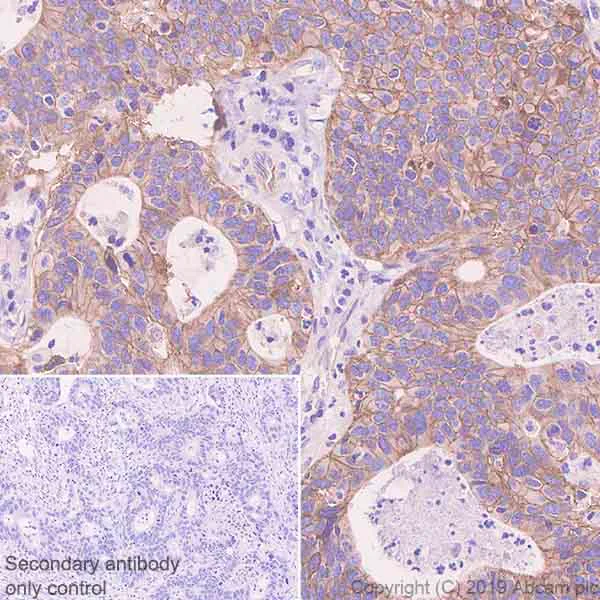 Immunohistochemistry (Formalin/PFA-fixed paraffin-embedded sections) - Anti-Poliovirus Receptor/PVR antibody [EPR23074-270] (AB267389)