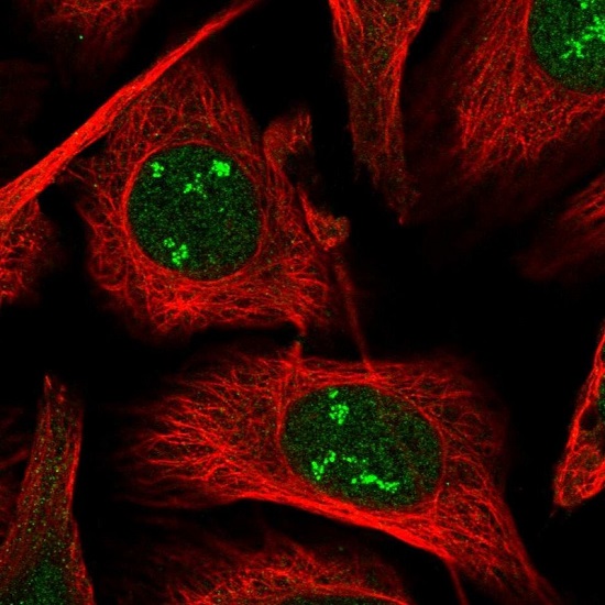 Immunocytochemistry/ Immunofluorescence - Anti-POLR1A antibody (AB222065), expandable thumbnail