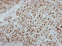 Immunohistochemistry (Formalin/PFA-fixed paraffin-embedded sections) - Anti-POLR1D antibody (AB104115), expandable thumbnail