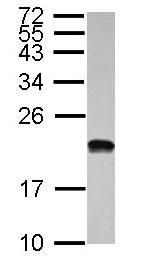 Western blot - Anti-POLR1D antibody (AB104115), expandable thumbnail