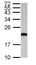 Western blot - Anti-POLR1D antibody (AB104115)