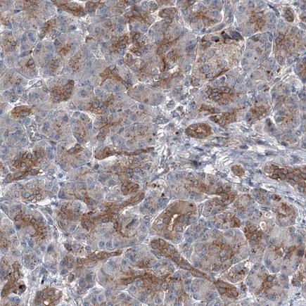 Immunohistochemistry (Formalin/PFA-fixed paraffin-embedded sections) - Anti-POLR1D antibody (AB243591), expandable thumbnail