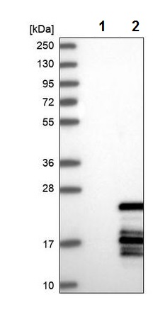 Western blot - Anti-POLR1D antibody (AB243591), expandable thumbnail