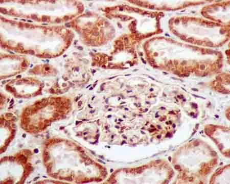 Immunohistochemistry (Formalin/PFA-fixed paraffin-embedded sections) - Anti-POLR2E/rpb5 antibody [EPR11750] - BSA and Azide free (AB250160)