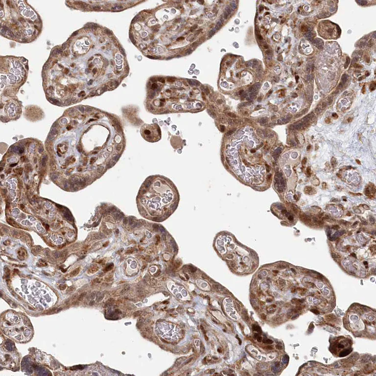 Immunohistochemistry (Formalin/PFA-fixed paraffin-embedded sections) - Anti-POLR3A antibody (AB247007)
