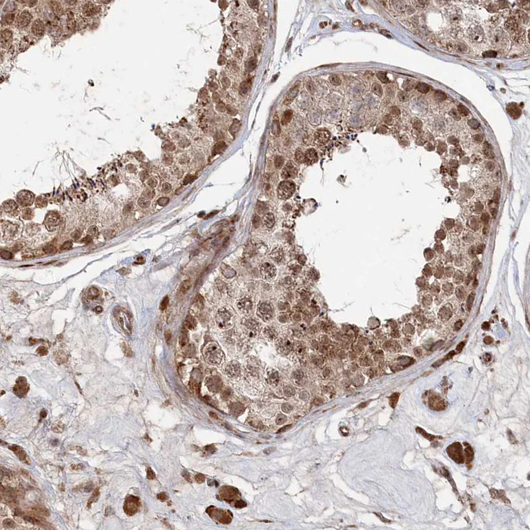 Immunohistochemistry (Formalin/PFA-fixed paraffin-embedded sections) - Anti-POLR3A antibody (AB247007)