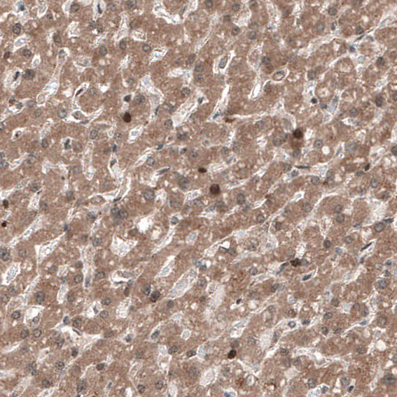 Immunohistochemistry (Formalin/PFA-fixed paraffin-embedded sections) - Anti-POLR3A antibody (AB247007)