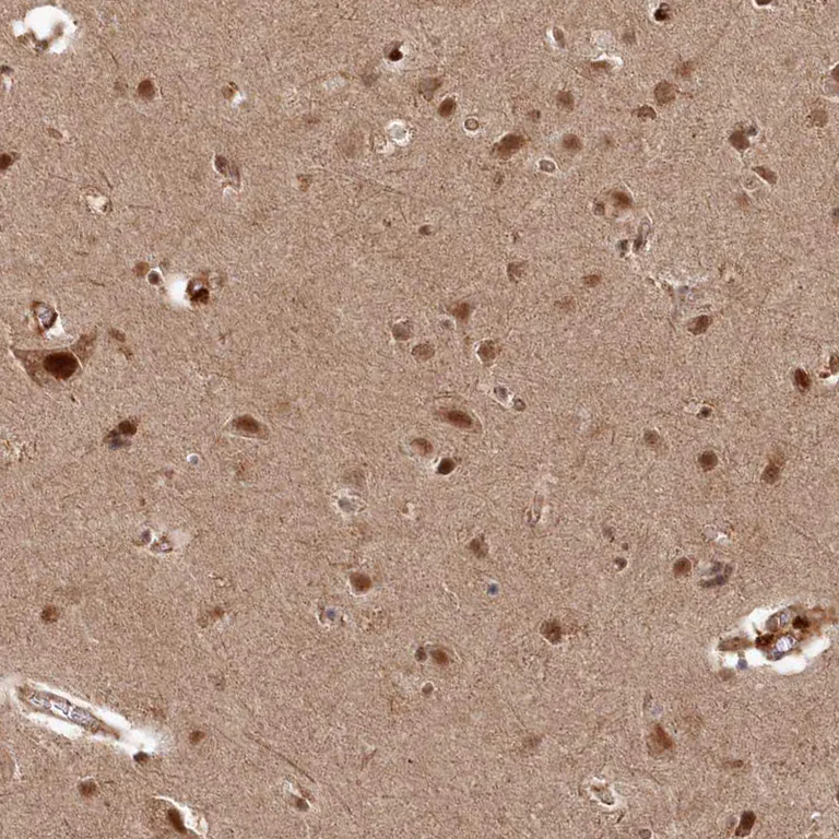 Immunohistochemistry (Formalin/PFA-fixed paraffin-embedded sections) - Anti-POLR3A antibody (AB247007)