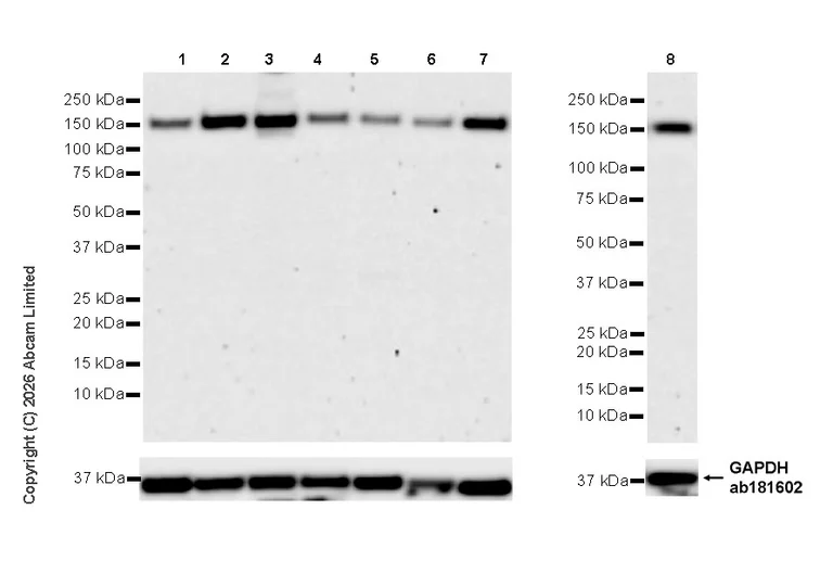 Western blot - Anti-POLR3A antibody [EPR30480-88] (AB325791)