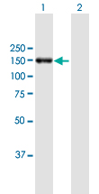 Western blot - Anti-POLRMT antibody (AB167368)