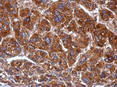 Immunohistochemistry (Formalin/PFA-fixed paraffin-embedded sections) - Anti-POLRMT antibody (AB228576)