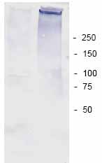 Western blot - Anti-Poly (ADP-Ribose) Polymer antibody (AB14460)
