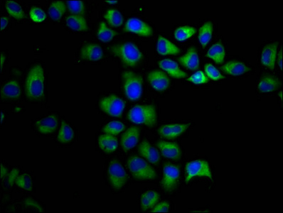 Immunocytochemistry/ Immunofluorescence - Anti-Polycystin 1/PC1 antibody (AB235963)