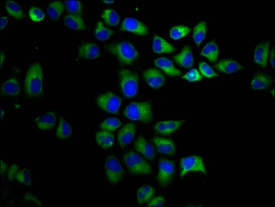 Immunocytochemistry/ Immunofluorescence - Anti-Polycystin 1/PC1 antibody (AB235963)