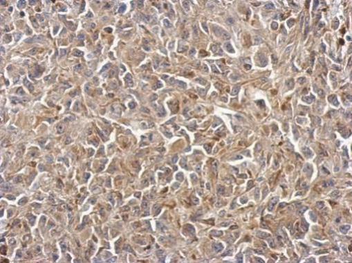 Immunohistochemistry (Formalin/PFA-fixed paraffin-embedded sections) - Anti-Polycystin 2 antibody (AB272890)