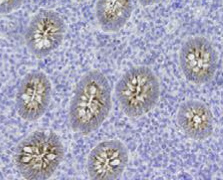 Immunohistochemistry (Formalin/PFA-fixed paraffin-embedded sections) - Anti-Polymeric immunoglobulin receptor/PIGR antibody [7C1] (AB170321)