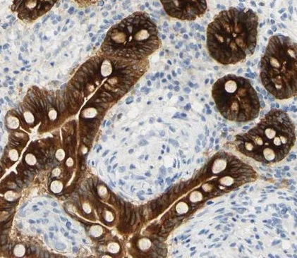 Immunohistochemistry (Formalin/PFA-fixed paraffin-embedded sections) - Anti-Polymeric immunoglobulin receptor/PIGR antibody (AB224086)