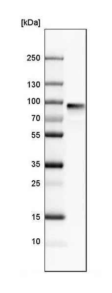 Western blot - Anti-Polymeric immunoglobulin receptor/PIGR antibody (AB224086)