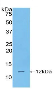 Western blot - Anti-Polymeric immunoglobulin receptor/PIGR antibody (AB231675)