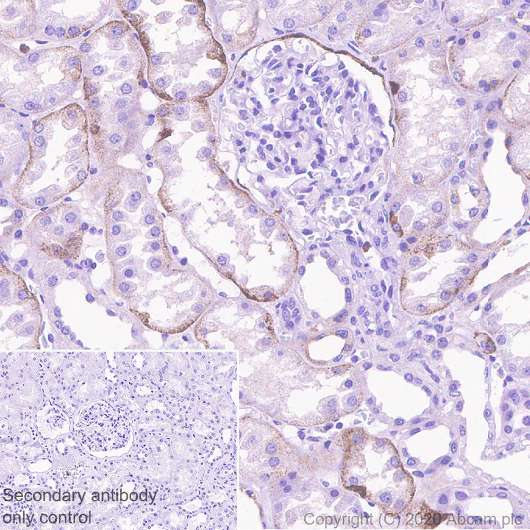 Immunohistochemistry (Formalin/PFA-fixed paraffin-embedded sections) - Anti-Polymeric immunoglobulin receptor/PIGR antibody [EPR23314-256] (AB275020)
