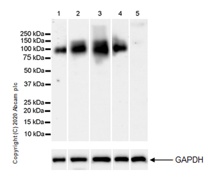 Western blot - Anti-Polymeric immunoglobulin receptor/PIGR antibody [EPR23314-78] (AB272728), expandable thumbnail