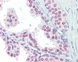 Immunohistochemistry (Formalin/PFA-fixed paraffin-embedded sections) - Anti-Polyubiquitin-C antibody (AB104455)
