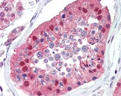 Immunohistochemistry (Formalin/PFA-fixed paraffin-embedded sections) - Anti-Polyubiquitin-C antibody (AB104455)