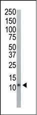 Western blot - Anti-Polyubiquitin-C antibody (AB104455)
