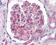 Immunohistochemistry (Formalin/PFA-fixed paraffin-embedded sections) - Anti-Polyubiquitin-C antibody (AB104651), expandable thumbnail