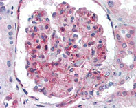 Immunohistochemistry (Formalin/PFA-fixed paraffin-embedded sections) - Anti-Polyubiquitin-C antibody (AB104651)