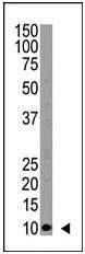 Western blot - Anti-Polyubiquitin-C antibody (AB104651), expandable thumbnail