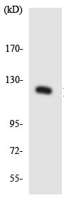 Western blot - Anti-POM121 antibody (AB137938), expandable thumbnail