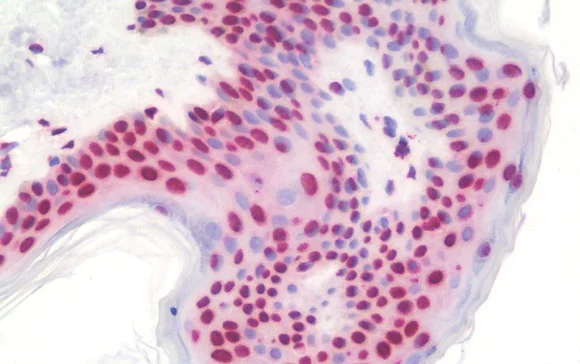 Immunohistochemistry (Formalin/PFA-fixed paraffin-embedded sections) - Anti-POM121 antibody (AB190015)