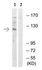 Western blot - Anti-POM121 antibody (AB190015)