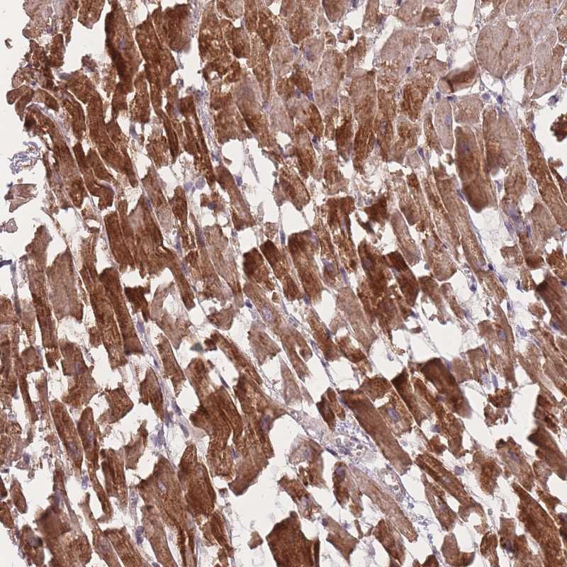 Immunohistochemistry (Formalin/PFA-fixed paraffin-embedded sections) - Anti-POM121 antibody (AB254920)
