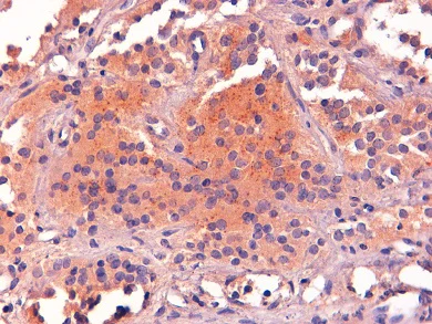 Immunohistochemistry (Formalin/PFA-fixed paraffin-embedded sections) - Anti-POMC antibody (AB32893)